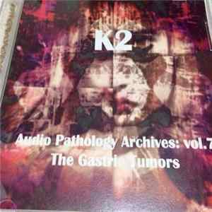 K2 - The Gastric Tumors mp3