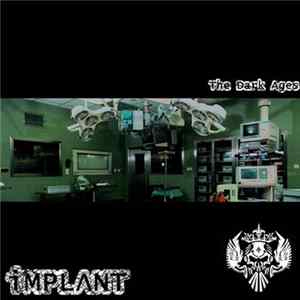 IMPLΛNT - The Dark Ages mp3