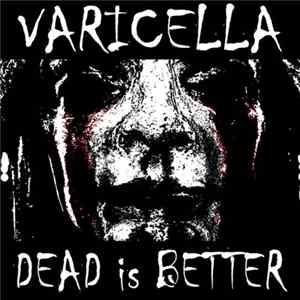 Varicella - Dead is Better mp3
