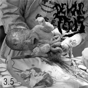 Devour The Fetus - 35 mp3