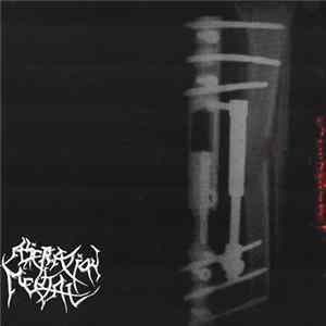 Alienation Mental - Kopferkingel mp3
