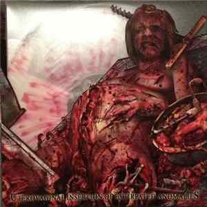 Cephalotripsy - Uterovaginal Insertion Of Extirpated Anomalies mp3