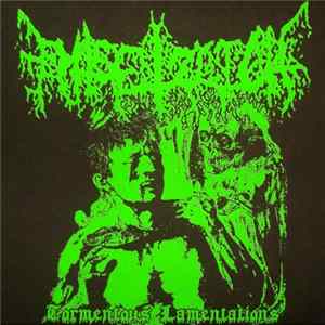Entsetzlich - Tormentous Lamentations mp3