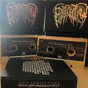 Epicardiectomy - Relics From Malodorous Pile mp3