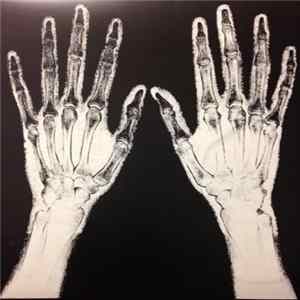 Sex Tide - Vernacular Splatter mp3