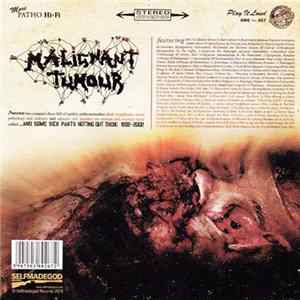 Malignant Tumour - ...And Some Sick Parts Rotting Out There 1992 - 2002 mp3